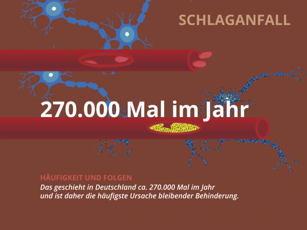 Schlaganfall / Häufigkeit